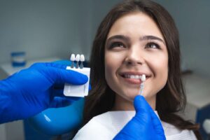 Perché scegliere faccette dentali? Come correggere il sorriso